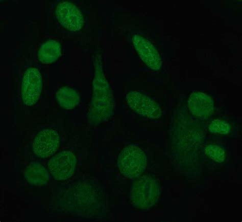 Anti-SSA/Ro autoantibodies - Wikiwand