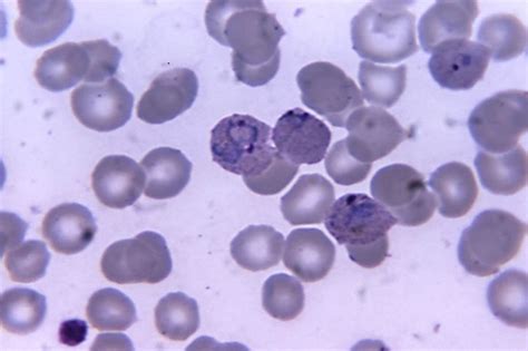 Free picture: micrograph, cells, malaria, vivax, trophozoites