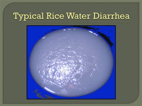 How to cure watery diarrhea. Effective Strategies for Managing and ...