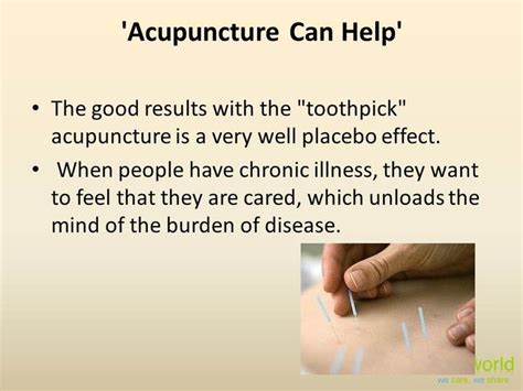 1000+ images about Benefits of Acupuncture on Pinterest | It works ...