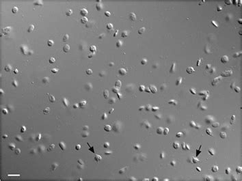 DIC microscopy of platelets and microparticles in a sample from an ...