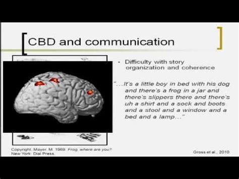 Overview of Corticobasal Degeneration and Progressive Supranuclear ...