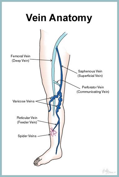 Varicose Veins - Advanced Vein Center