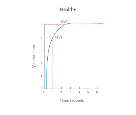 Normal Spirometry Chart: A Visual Reference of Charts | Chart Master