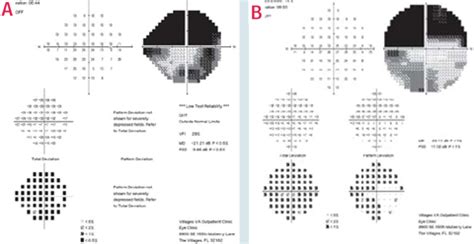 10-2 Visual Field Testing: A Tool for All Glaucoma Stages