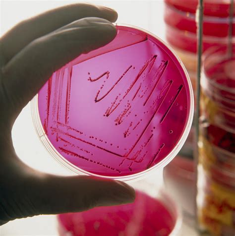 Gloved Hand Holds Petri Dish Of Cultured Bacteria Photograph by Tek Image