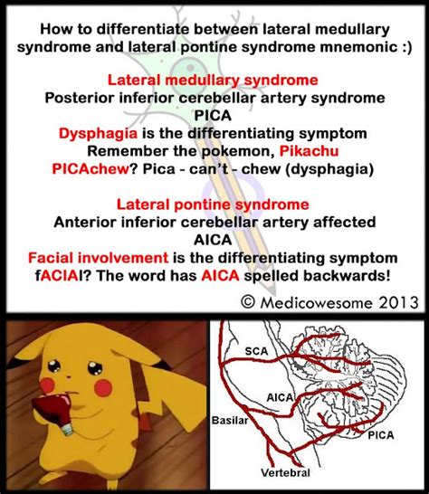 Medicowesome: Lateral medullary syndrome and lateral pontine syndrome ...