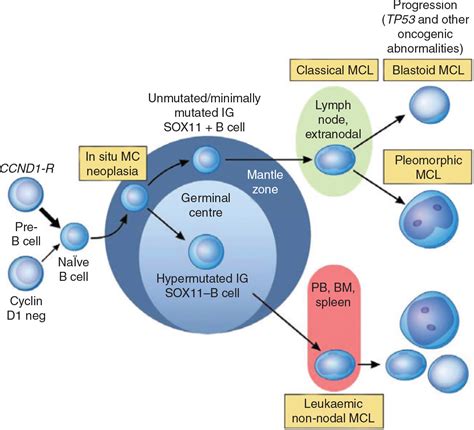 Newly diagnosed and relapsed mantle cell lymphoma: ESMO Clinical Practice Guidelines for ...