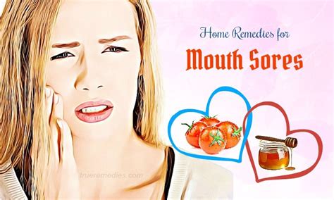 14 Home Remedies For Mouth Sores Reduction On Tongue & Lips