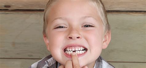 My Child is Missing a Tooth. What are Our Options?