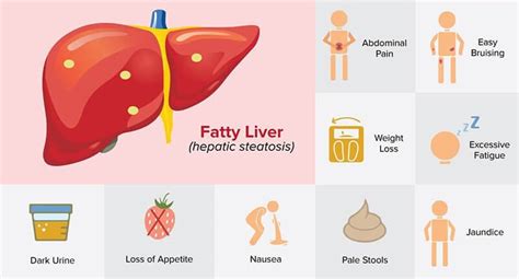 IMC | Fatty Liver Disease (Hepatic Steatosis)