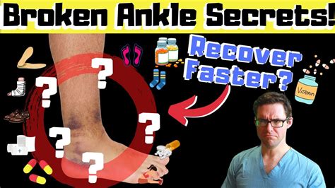 Get a FAST Broken Ankle Fracture Recovery [DOCTOR SECRETS REVEALED]