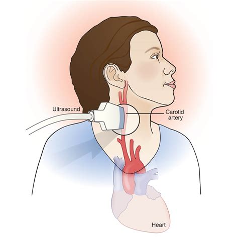 Ultrasound of carotid artery | Battista Illustration