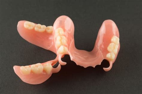 When Should I Get My Partial Dentures Repaired? - Smiles in the Village ...