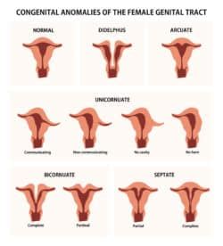 Uterine Anomalies - OB-GYN New York | Gynecologists in New York