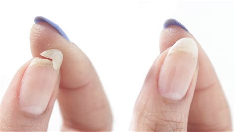 The 6 Most Annoying Problems You Have With Your Nails, And How To Fix Them | Stellar