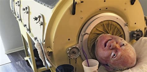 Video: Man using iron lung machine to breathe for nearly 70 years