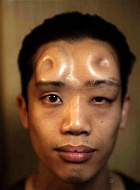 Japanese Art of Bagel Head Saline Body Modification | Find a Tattoo Blog