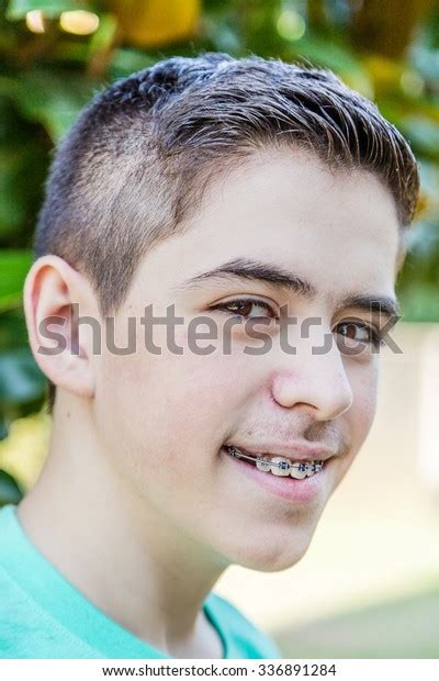 Boy Pimples Dermatitis Skin Problems Typical Stock Photo 336891284 | Shutterstock