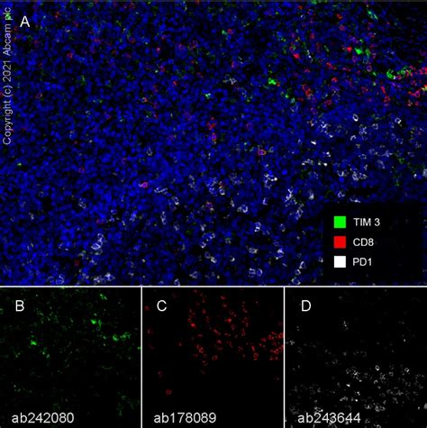 Recombinant Anti-TIM 3 antibody [EPR22241] - BSA and Azide free (ab242080)