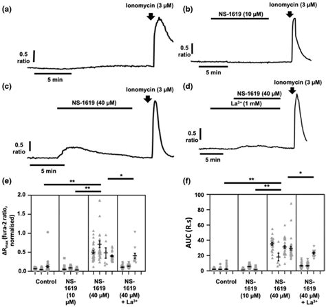 Hyperpolarization of the membrane potential (Vm) plays no role in ...