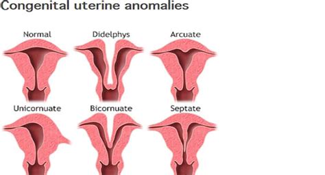 Uterine Abnormalities: When Laparoscopy May Be Needed? | TheHealthSite.com