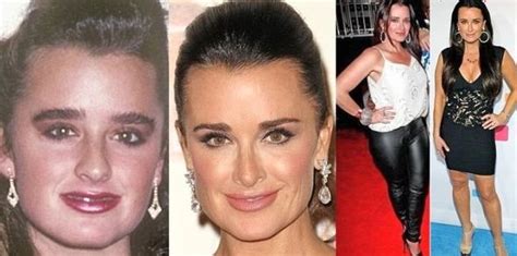 Kyle Richards plastic surgery – did she really needed to change so ...