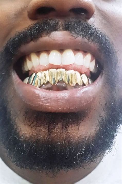 Gold Grillz Miami | Grillz, Diamond grillz, White gold grillz