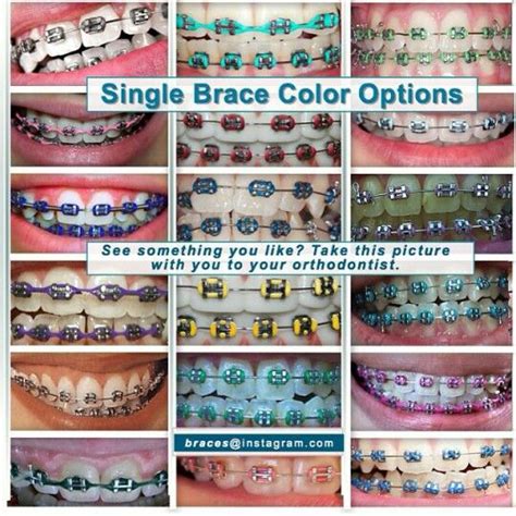 Braces For Teeth Colors