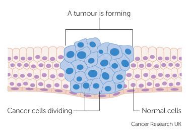 Cancer cells | Cancer Research UK