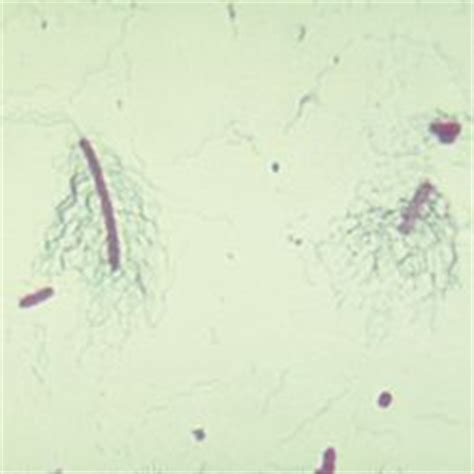 Bacterial Flagella Slide, Peritrichous, w.m. | Carolina.com