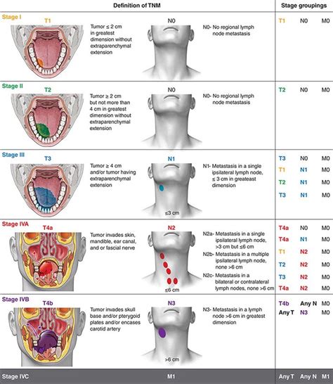 Tnm Staging Lung Cancer Lymph Nodes