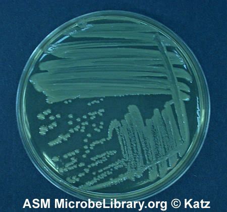 Bacterial Streak Plate