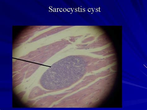 Apicomplexa structure Phylum Apicomplexa Class Sporozoea Subcl Coccidia