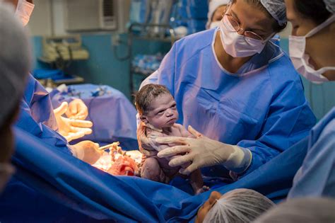 Brazilian baby goes viral for epic scowl moments after birth