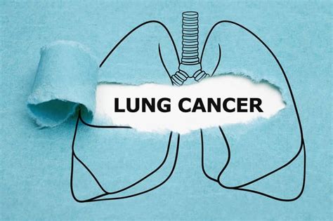 Datopotamab Deruxtecan Improved NSCLC Survival | RT