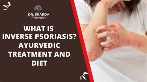 What is Inverse Psoriasis? Ayurvedic Treatment and Diet for Intertriginous Psoriasis