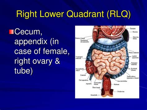 Pain Lower Right Quadrant Anatomy