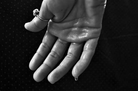 What Causes Clammy Hands? 7 Reasons & How To Stop It