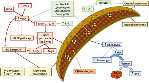 Frontiers | Middle Meningeal Artery Embolization in Chronic Subdural Hematoma: Implications of ...