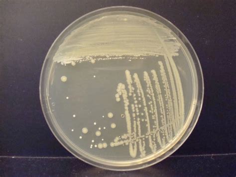 ASEPTIC TRANSFER AND ISOLATION TECHNIQUES – Laboratory Exercises in Microbiology