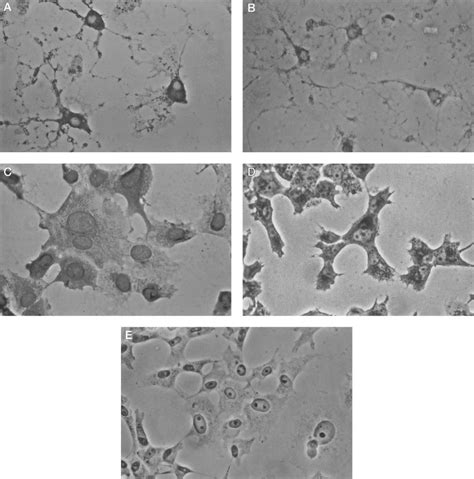 Immunocytochemical identification of the thromboxane A 2 receptors on ...