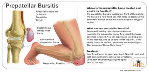 Knee Bursitis Treatment