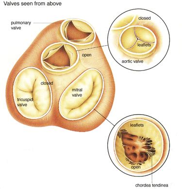 Mitral Valve Leaflets - Anatomy, Pictures, Problems