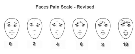 Faces Pain Scale - Revised | Bone and Spine