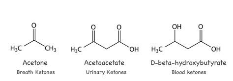 what are ketone bodies Ketone liver usmle mitochondrial peripheral ...