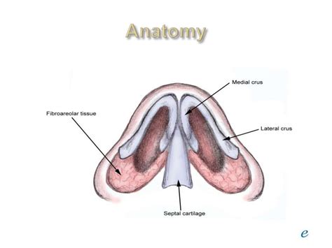 Septal hemotoma