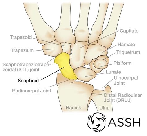 Carpal Bone Diagram