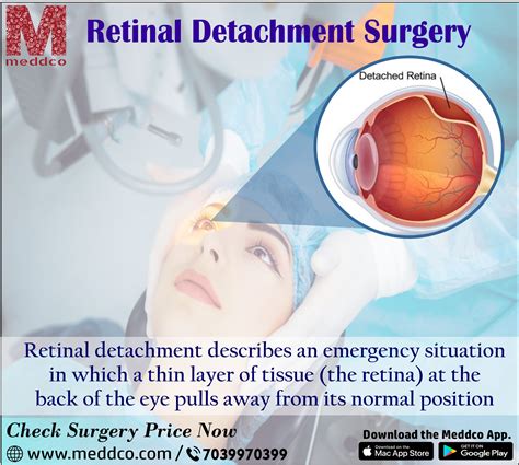 Retinal detachment surgery - An Overview