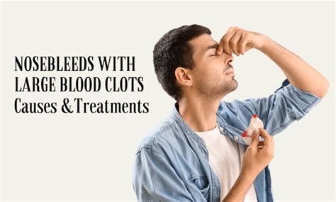 What Causes Nosebleeds with Large Blood Clots? Causes And Treatments